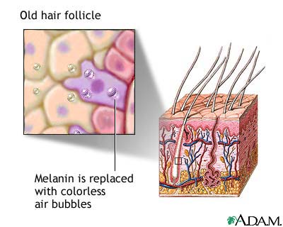 Aged hair follicle