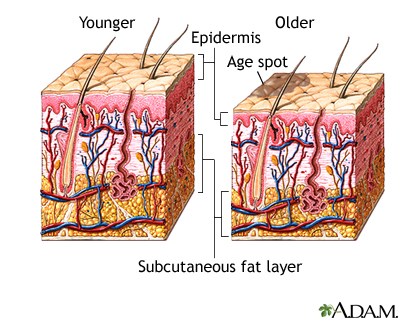 Changes in skin with age