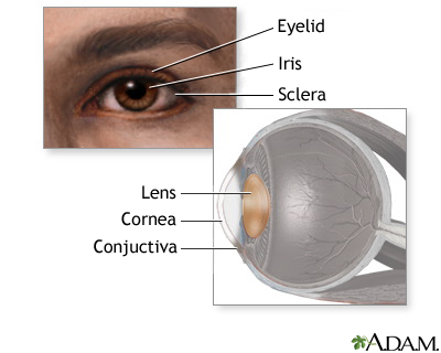 Eye lens anatomy: MedlinePlus Medical Encyclopedia Image