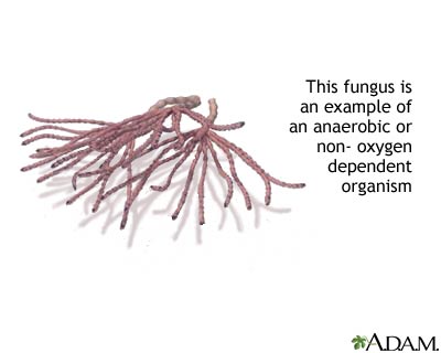 Anaerobic organism
