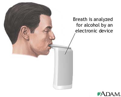 Breath alcohol test