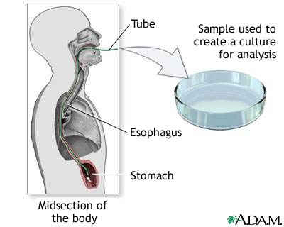 Culture of gastric tissue biopsy