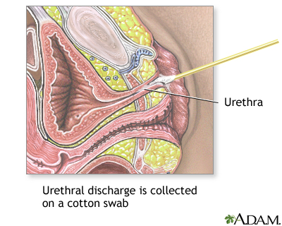 Gram stain of urethral discharge