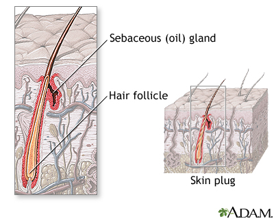 Hair follicle anatomy: MedlinePlus Medical Encyclopedia Image