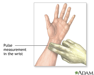 Radial Pulse