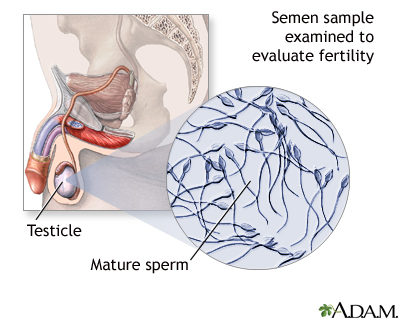 sperm Semen collection medical steps video