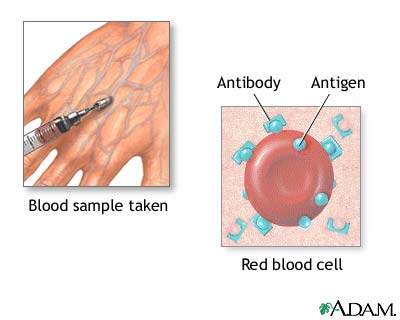 Herpes blood test