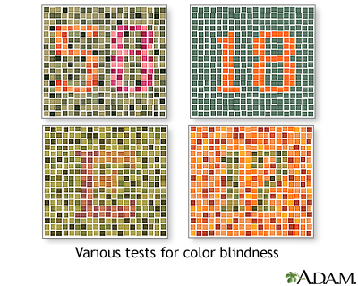 Color blindness tests