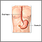 Gastrostomy tube placement - series