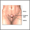 Pelvic laparoscopy - series