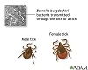 Tertiary Lyme disease