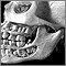 Teeth, adult - in the skull