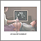 Prenatal ultrasound - series - Procedure, part 1