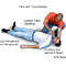 First aid convulsions, part 1
