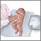 Umbilical cord care in newborns: MedlinePlus Medical ...
