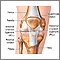 Anterior cruciate ligament repair - series