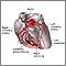 Coronary artery fistula