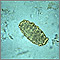 Ascaris lumbricoides egg