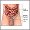 Inguinal hernia repair - series