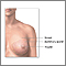 Normal female breast anatomy