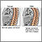Changes in spine with age