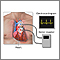 Holter heart monitor