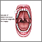 Gum biopsy