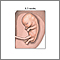 Fetus at 8.5 weeks
