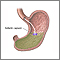 Gelatin capsule in stomach