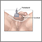 Testicular ultrasound