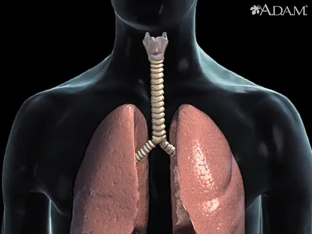 Cancer of the throat or larynx - Health Video: MedlinePlus Medical  Encyclopedia