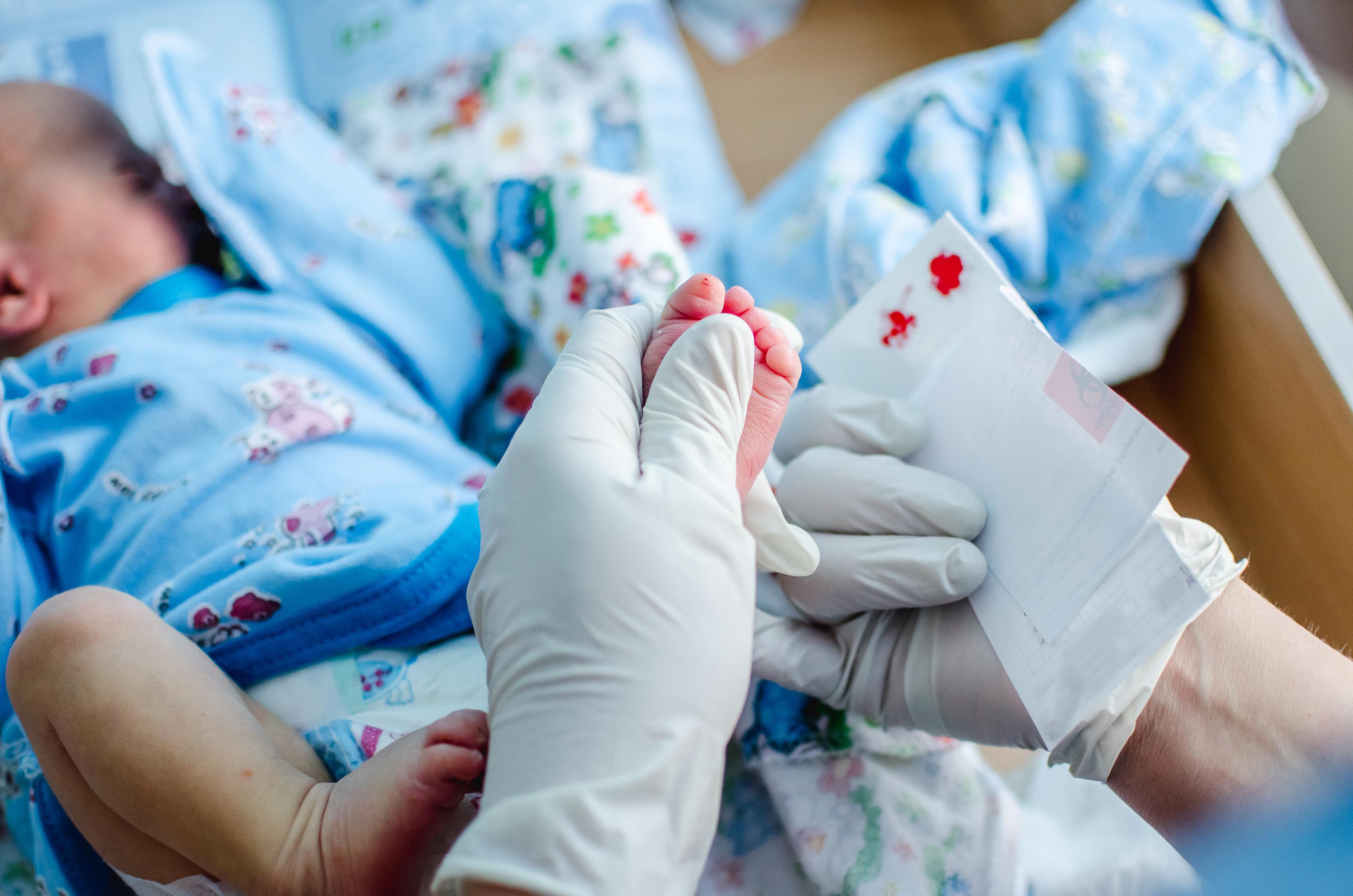 5 заболеваний новорожденных. Неонатальный скрининг новорожденных. Неонатальный скрининг тест Гатри. Неонатальный скрининг новорожденных 2022. Неонатальный скрининг новорожденных 2023.