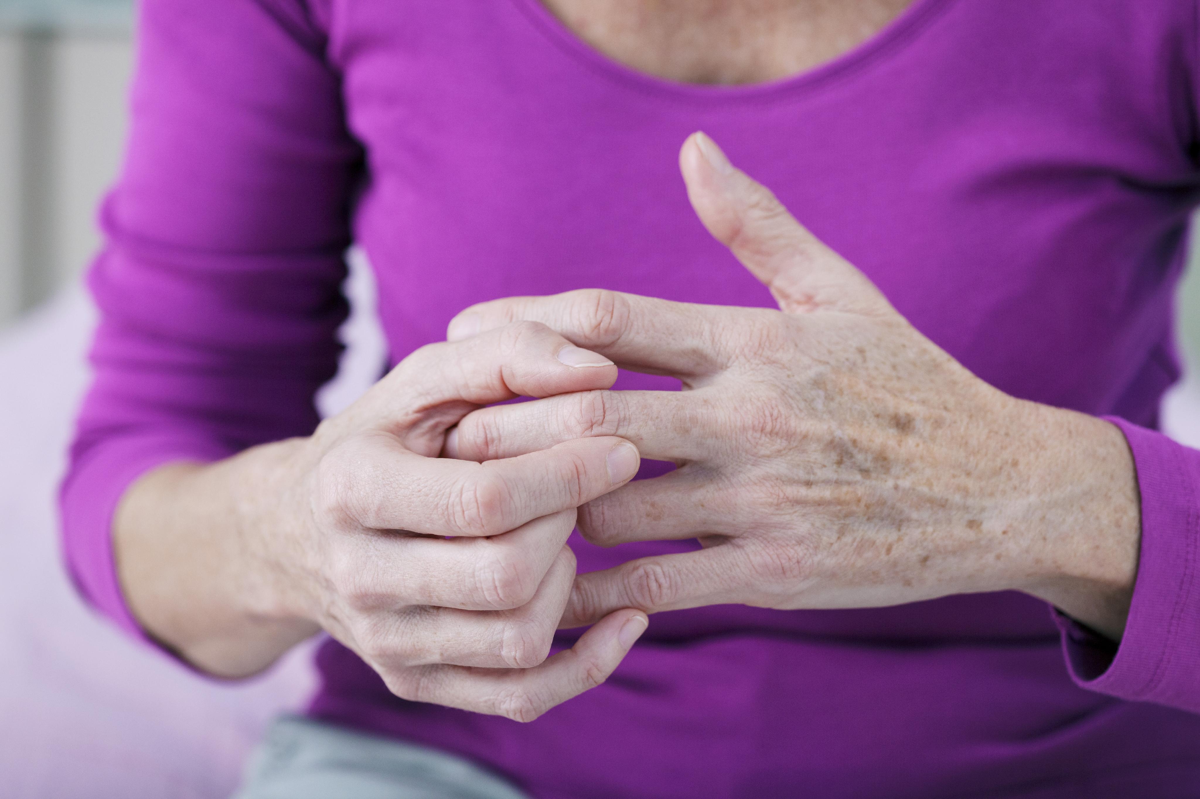 rheumatoid arthritis és osteoarthritis közös kezelés tejjel