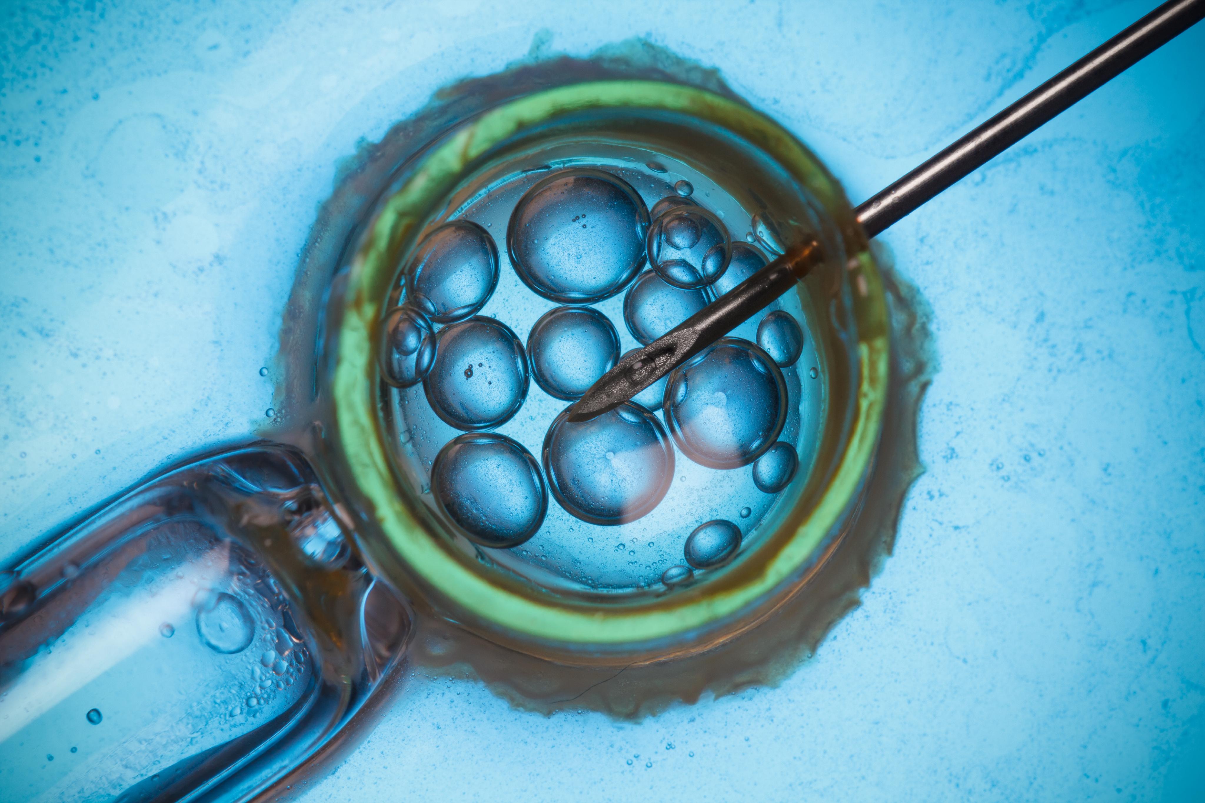 Assisted Reproductive Technology IVF MedlinePlus