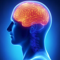Brain Aneurysm | MedlinePlus