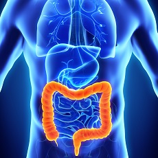Sintomas de cancer de colon rectal. Cancer de colon que produce