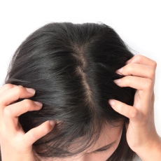 Dandruff, Cradle Cap, and Other Scalp Conditions