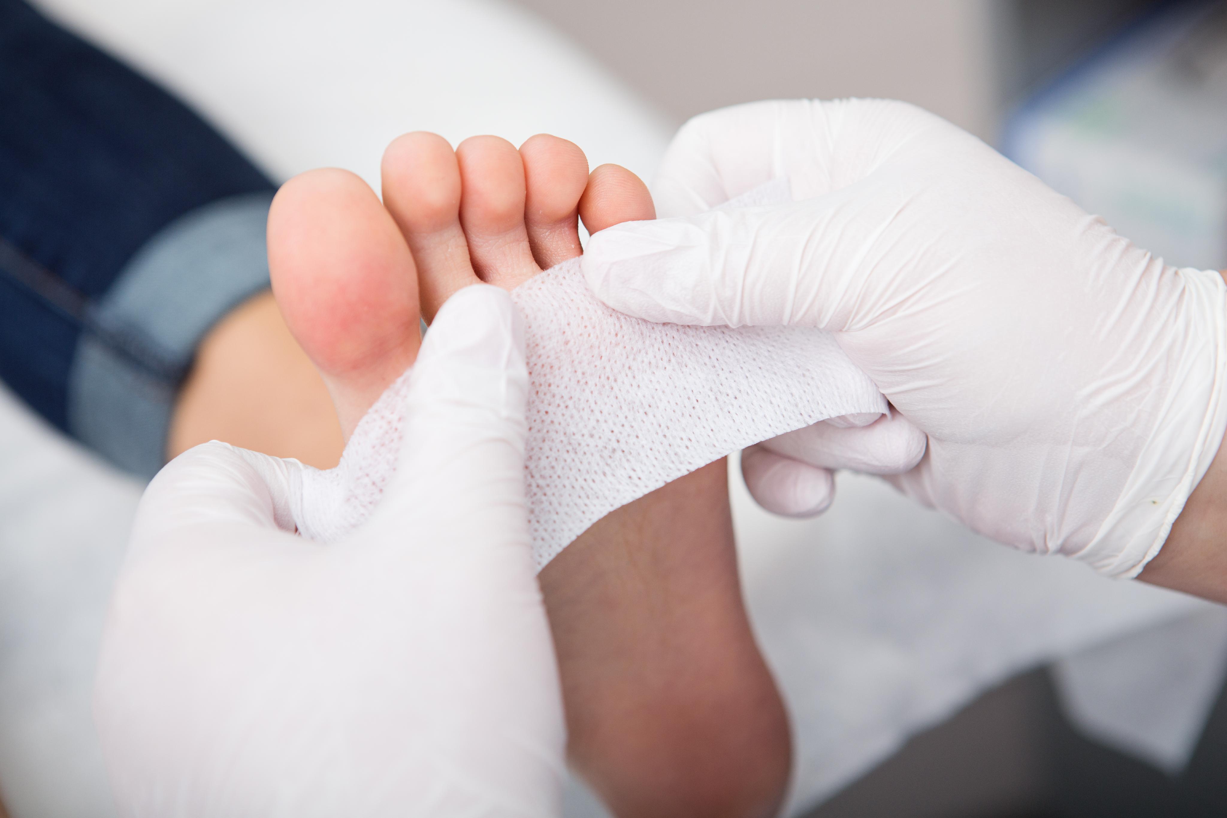 Identifying common foot conditions - The Pharmaceutical Journal
