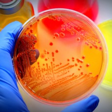 Infecciones por Escherichia coli