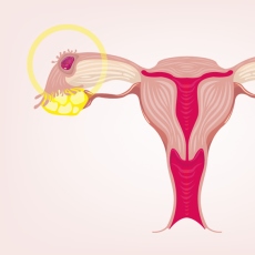 Ectopic Pregnancy | Tubal Pregnancy | MedlinePlus
