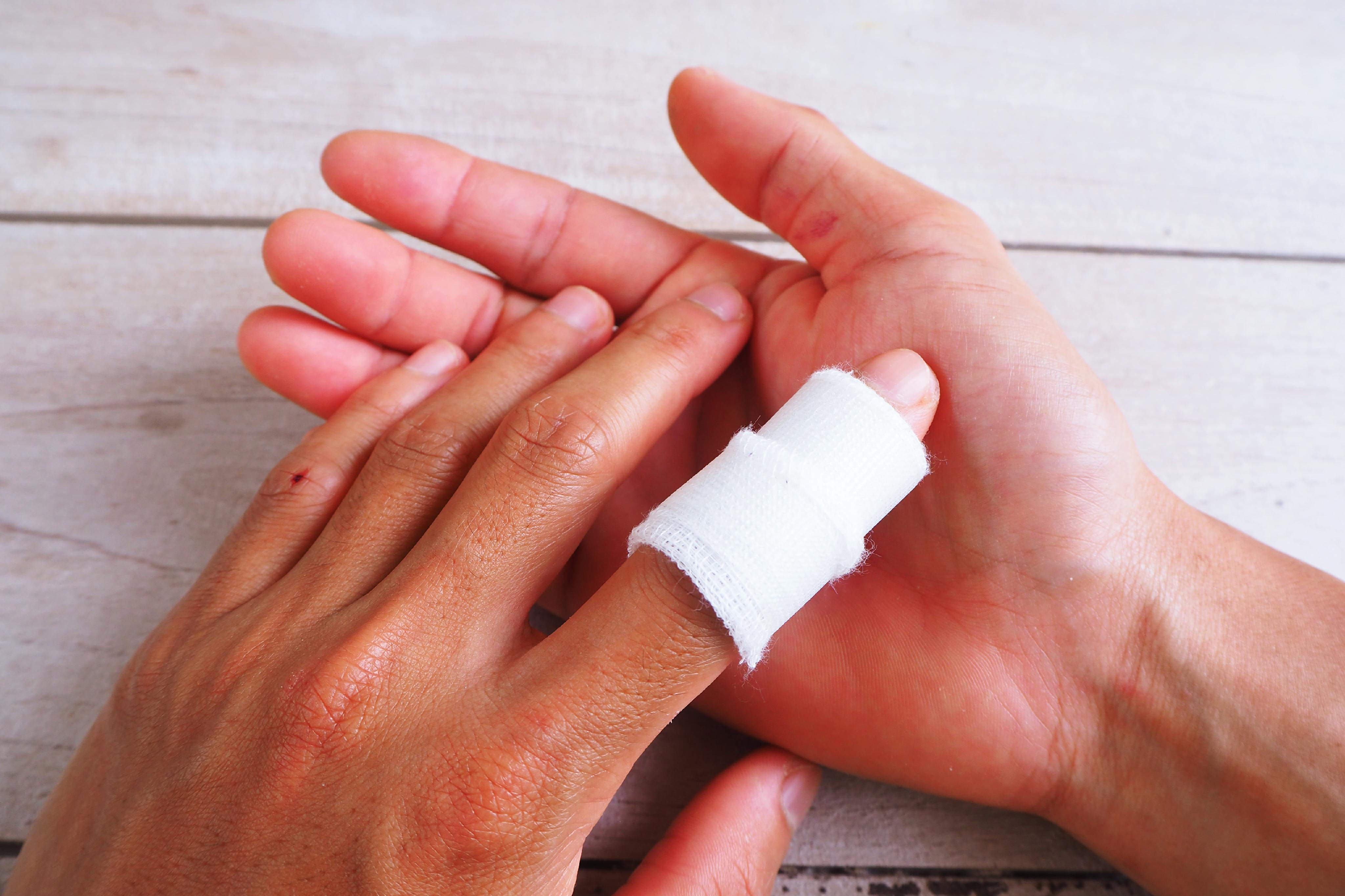 y enfermedades de los dedos: MedlinePlus en español