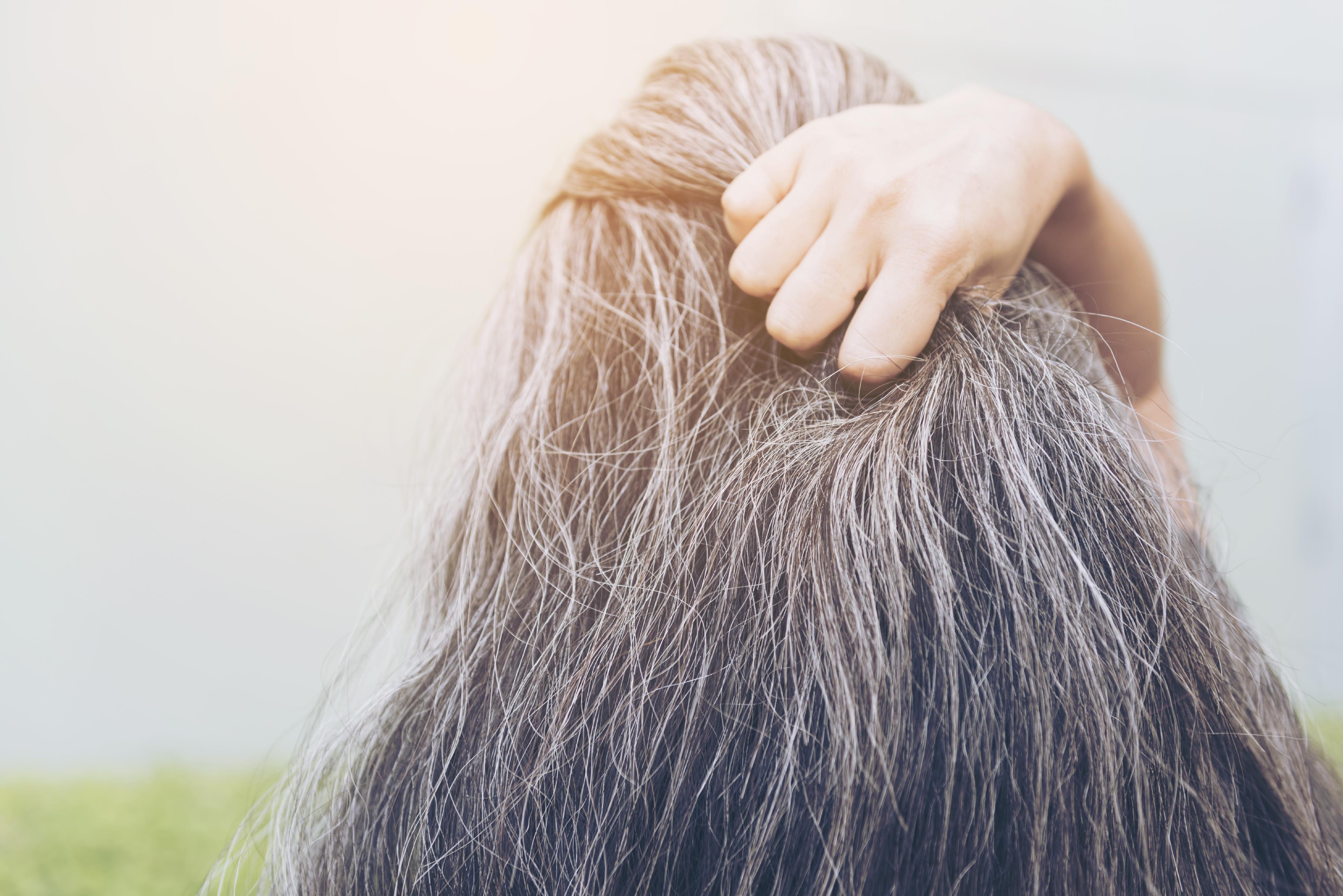 Hair problems | Hair loss | MedlinePlus