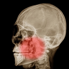 Jaw Injuries and Disorders
