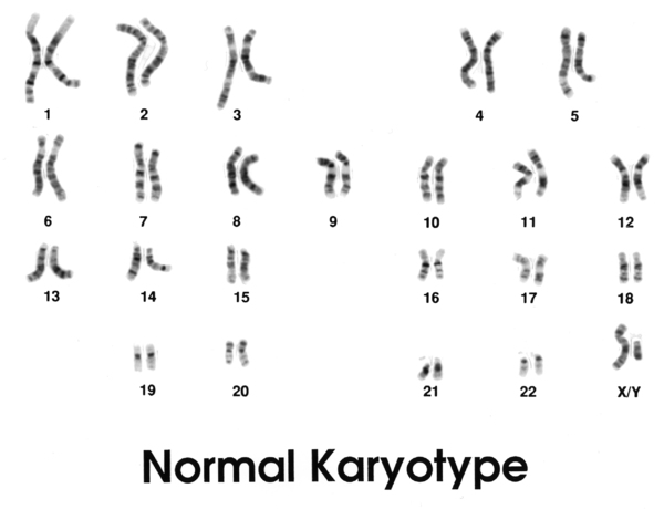 xy chromosome