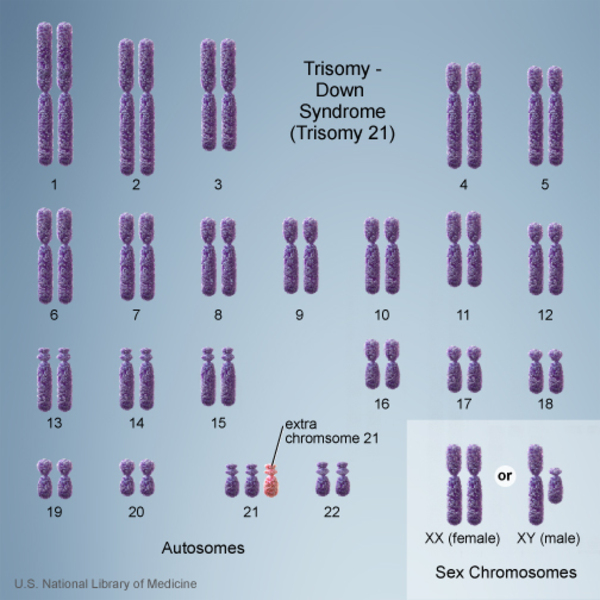down syndrome chromosomes affected