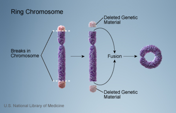 diagram of chromosome with gene