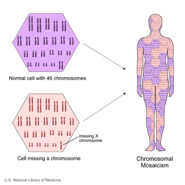 Pallister Killian Mosaic Syndrome Medlineplus Genetics