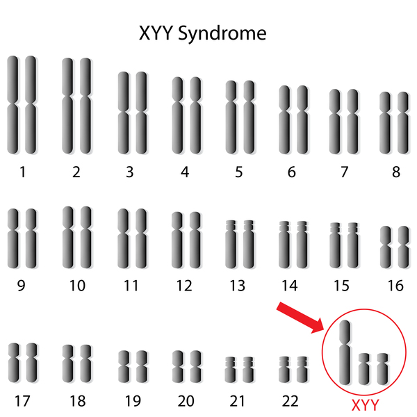 xy chromosome karyotype