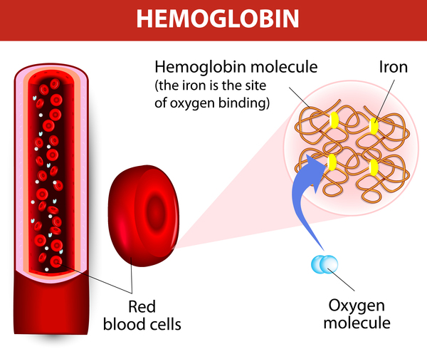 sickle cell anemia hemoglobin