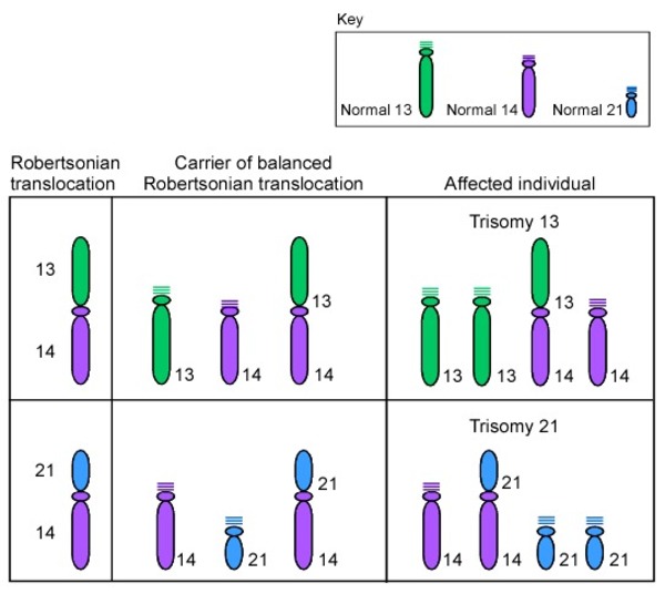 Down Syndrome MedlinePlus Genetics